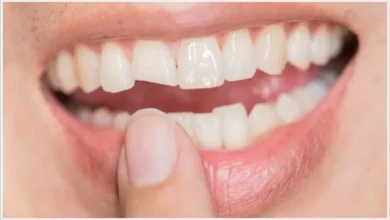 Diş Kırılması Önlenebilir Mi?